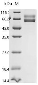 Recombinant Human Transforming growth factor beta-1 proprotein (TGFB1), Homo sapiens (Human), Mammalian cell, N-terminal hFc1-tagged, 67.3kDa, purity >95% as determined by SDS-PAGE.