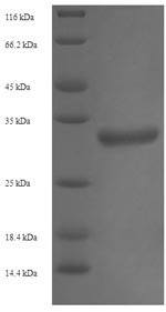 Recombinant Human Trimethylguanosine synthase (TGS1), partial, Homo sapiens (Human), E.coli, N-terminal 6xHis-SUMO-tagged, 31.6kDa, purity >90% as determined by SDS-PAGE.