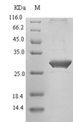 Recombinant Human T-cell immunoreceptor with Ig and ITIM domains (TIGIT), partial, Homo sapiens (Human), E.coli, N-terminal 6xHis-SUMO-tagged, 26.0kDa, purity >90% as determined by SDS-PAGE.