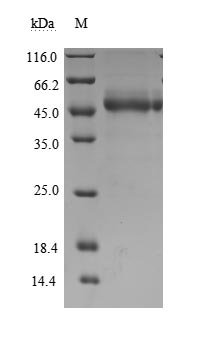Recombinant Human T-cell immunoreceptor with Ig and ITIM domains (TIGIT), partial (Active)