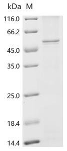 Recombinant Human Secretin receptor (SCTR) Protein, Homo sapiens (Human), in vitro E.coli expression system, N-terminal 10xHis-tagged, 53.9kDa, purity >85% as determined by SDS-PAGE.