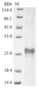 Recombinant Human Insulin-like growth factor-binding protein 3 receptor (TMEM219), partial