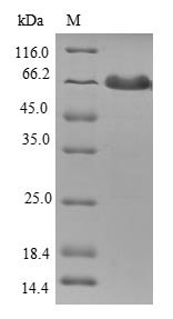 Recombinant Human Tropomodulin-1 (TMOD1), Homo sapiens (Human), E.coli, N-terminal GST-tagged, 67.6kDa, purity >90% as determined by SDS-PAGE.