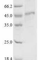 (Tris-Glycine gel) Discontinuous SDS-PAGE (reduced) with 5% enrichment gel and 15% separation gel.