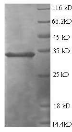 Recombinant Human Tumor necrosis factor-inducible gene 6 protein (TNFAIP6), Homo sapiens (Human), E.coli, N-terminal 6xHis-tagged, 33.1kDa, purity >90% as determined by SDS-PAGE.
