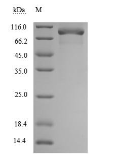 Recombinant Human Tumor necrosis factor receptor superfamily member 11B (TNFRSF11B) (Active), Homo sapiens (Human), Mammalian cell, C-terminal hFc1-Flag-tagged, 73.5kDa, purity >90% as determined by SDS-PAGE.