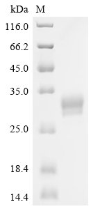 Recombinant Human Tumor necrosis factor ligand superfamily member 15 (TNFSF15), partial, Biotinylated (Active)