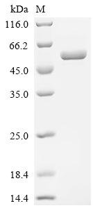 Recombinant Human Tumor necrosis factor ligand superfamily member 9 (TNFSF9), partial, Biotinylated, Homo sapiens (Human), Mammalian cell, C-terminal hFc1-Avi-tagged, 50.6kDa, purity >95% as determined by SDS-PAGE.