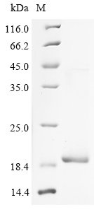 Recombinant Human Troponin C, slow skeletal and cardiac muscles (TNNC1), Homo sapiens (Human), E.coli, N-terminal 6xHis-tagged, 21.0kDa, purity >90% as determined by SDS-PAGE.