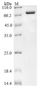 Recombinant Human DNA topoisomerase 1 (TOP1), partial, Homo sapiens (Human), Baculovirus, N-terminal 10xHis-tagged and C-terminal Myc-tagged, 72.2kDa, purity >90% as determined by SDS-PAGE.