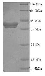 Recombinant Human Thyroid peroxidase (TPO), partial, Homo sapiens (Human), Yeast, N-terminal 6xHis-tagged, 17.9kDa, purity >90% as determined by SDS-PAGE.