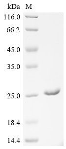 Recombinant Human Translationally-controlled tumor protein (TPT1), Homo sapiens (Human), E.coli, Tag-Free, 19.6kDa, purity >90% as determined by SDS-PAGE.