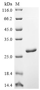 Recombinant Human Translationally-controlled tumor protein (TPT1), Homo sapiens (Human), E.coli, N-terminal 6xHis-tagged, 23.7kDa, purity >90% as determined by SDS-PAGE.