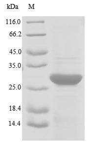 Recombinant Human Transformer-2 protein homolog beta (TRA2B), partial