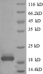 Recombinant Human T cell receptor alpha chain constant (TRAC), Homo sapiens (Human), E.coli, N-terminal 6xHis-tagged, 19.9kDa, purity >90% as determined by SDS-PAGE.
