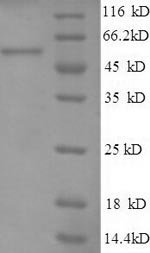 Recombinant Human Heat shock protein 75 kDa, mitochondrial (TRAP1), partial