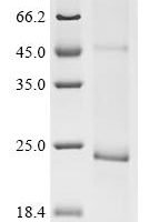 (Tris-Glycine gel) Discontinuous SDS-PAGE (reduced) with 5% enrichment gel and 15% separation gel.