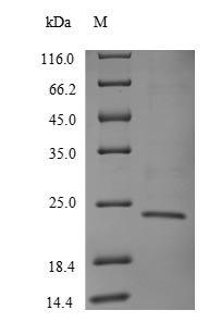 Recombinant Human T cell receptor beta constant 1 (TRBC1), partial
