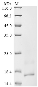 Recombinant Human T cell receptor beta constant 2 (TRBC2), partial