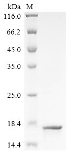 Recombinant Human T cell receptor beta variable 19 (TRBV19), Homo sapiens (Human), E.coli, N-terminal 10xHis-tagged, 16.7kDa, purity >85% as determined by SDS-PAGE.