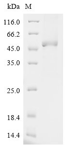 Recombinant Human E3 ubiquitin-protein ligase TRIM21 (TRIM21)