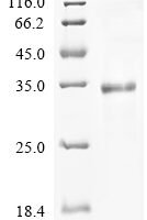 (Tris-Glycine gel) Discontinuous SDS-PAGE (reduced) with 5% enrichment gel and 15% separation gel.