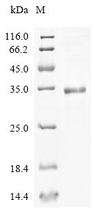 Recombinant Helicobacter pylori Prolipoprotein diacylglyceryl transferase (lgt) Protein, Helicobacter pylori (strain ATCC 700392 / 26695) (Campylobacter pylori), in vitro E.coli expression system, N-terminal 10xHis-tagged, 38.7kDa, purity >85% as determined by SDS-PAGE.