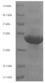 Recombinant Human Transcription intermediary factor 1-alpha (TRIM24), partial