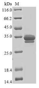 Recombinant Human Tripartite motif-containing protein 72 (TRIM72), partial, Homo sapiens (Human), Baculovirus, N-terminal 10xHis-tagged and C-terminal Myc-tagged, 33.4kDa, purity >85% as determined by SDS-PAGE.