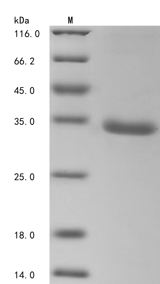 Recombinant Human Tripartite motif-containing protein 72 (TRIM72), partial