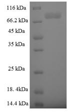 Recombinant Human E3 ubiquitin-protein ligase TRIM9 (TRIM9), Homo sapiens (Human), E.coli, N-terminal 6xHis-SUMO-tagged, 77.3kDa, purity >90% as determined by SDS-PAGE.
