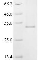 (Tris-Glycine gel) Discontinuous SDS-PAGE (reduced) with 5% enrichment gel and 15% separation gel.