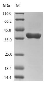 Recombinant Human Tumor susceptibility gene 101 protein (TSG101), partial