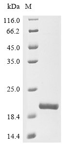 Recombinant Human Tumor susceptibility gene 101 protein (TSG101), partial, Homo sapiens (Human), E.coli, N-terminal 6xHis-tagged, 20.7kDa, purity >90% as determined by SDS-PAGE.