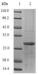 Recombinant Human Thyrotropin subunit beta (TSHB), Homo sapiens (Human), E.coli, N-terminal 6xHis-SUMO-tagged, 28.9kDa, purity >90% as determined by SDS-PAGE.