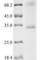 (Tris-Glycine gel) Discontinuous SDS-PAGE (reduced) with 5% enrichment gel and 15% separation gel.