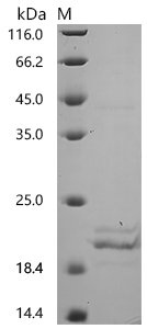 Recombinant Human Transthyretin (TTR)