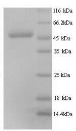 Recombinant Human Elongation factor Tu, mitochondrial (TUFM)