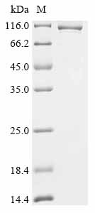 Recombinant Human Splicing factor U2AF 65 kDa subunit (U2AF2), Biotinylated, Homo sapiens (Human), E.coli, N-terminal MBP-tagged and C-terminal 6xHis-Avi-tagged, 101.2kDa, purity >85% as determined by SDS-PAGE.