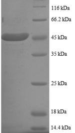 Recombinant Human SUMO-conjugating enzyme UBC9 (UBE2I), partial