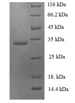 Recombinant Human Ubiquitin-conjugating enzyme E2 variant 2 (UBE2V2)