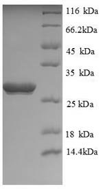 Recombinant Human Ubiquitin carboxyl-terminal hydrolase isozyme L1 (UCHL1), partial