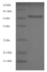 Recombinant Human Ubiquitin carboxyl-terminal hydrolase isozyme L5 (UCHL5), Homo sapiens (Human), E.coli, N-terminal 6xHis-SUMO-tagged, 53.4kDa, purity >90% as determined by SDS-PAGE.