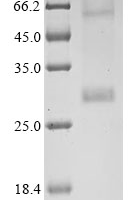 (Tris-Glycine gel) Discontinuous SDS-PAGE (reduced) with 5% enrichment gel and 15% separation gel.