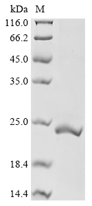 Recombinant Human Urocortin-3 (UCN3)