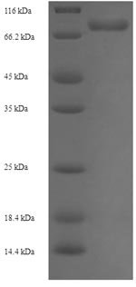 Recombinant Human UDP-glucose 6-dehydrogenase (UGDH), Homo sapiens (Human), E.coli, N-terminal 6xHis-SUMO-tagged, 71.0kDa, purity >90% as determined by SDS-PAGE.