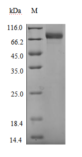 Recombinant Human UL16-binding protein 1 (ULBP1), Biotinylated (Active)