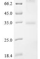 (Tris-Glycine gel) Discontinuous SDS-PAGE (reduced) with 5% enrichment gel and 15% separation gel.