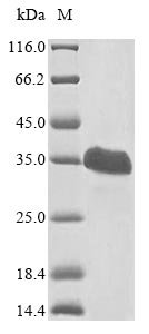 Recombinant Human Von Hippel-Lindau disease tumor suppressor (VHL)