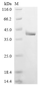 Recombinant Human Vacuolar protein sorting-associated protein 13D (VPS13D), partial